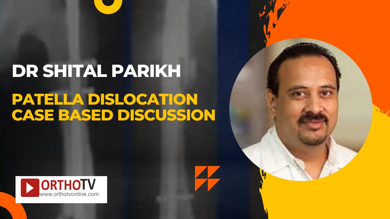 Patella Dislocation Case based discussion Dr Shital Parikh