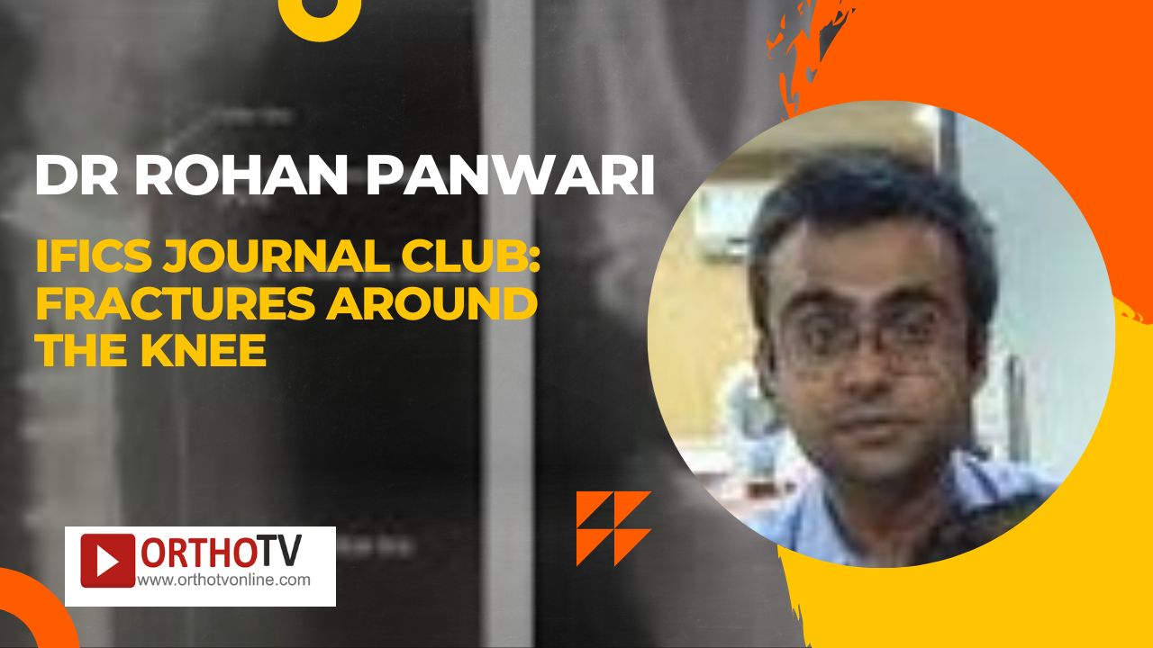 IFICS journal club: Fractures around the Knee : Dr Rohan Panwari