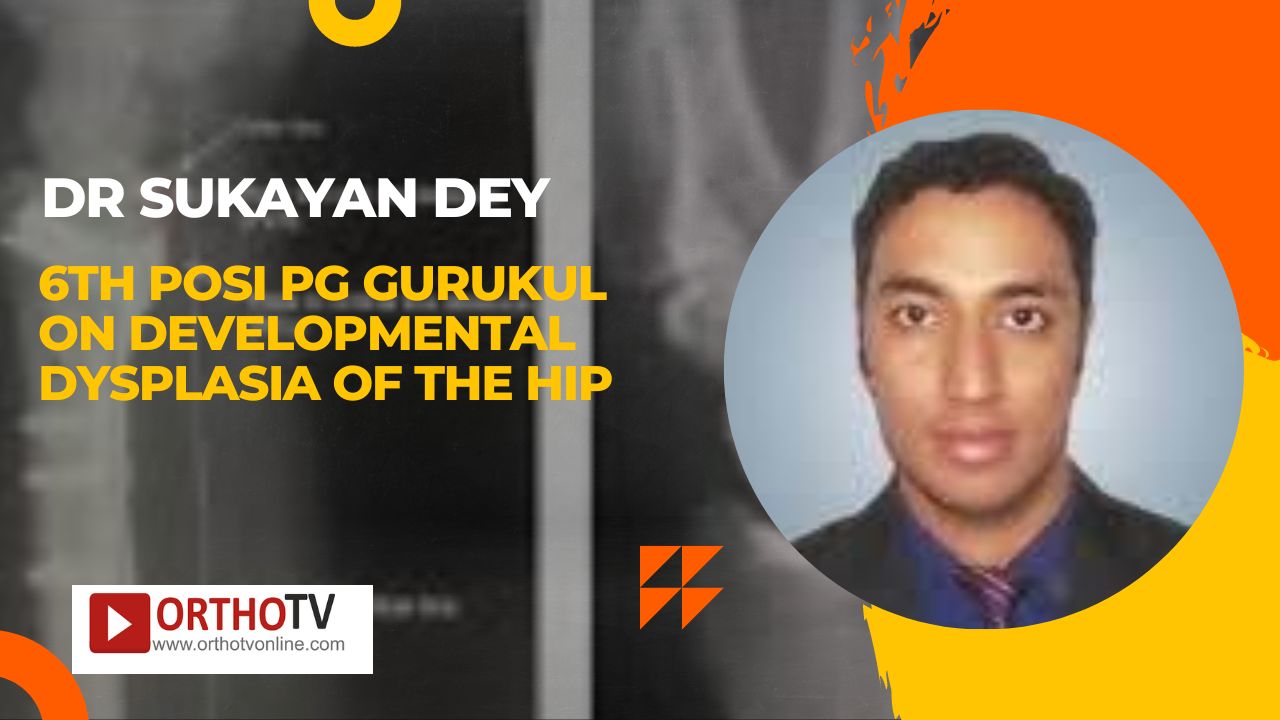 6th POSI PG Gurukul on Developmental Dysplasia of the Hip : Dr Sukayan Dey