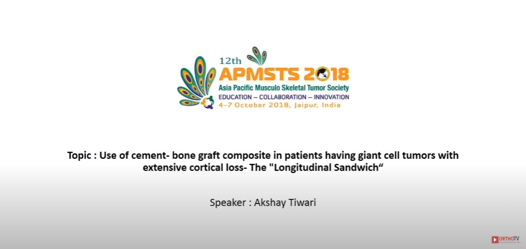 Use of cement- bone graft composite in patients having giant cell Dr Akshay Tiwari APMSTS