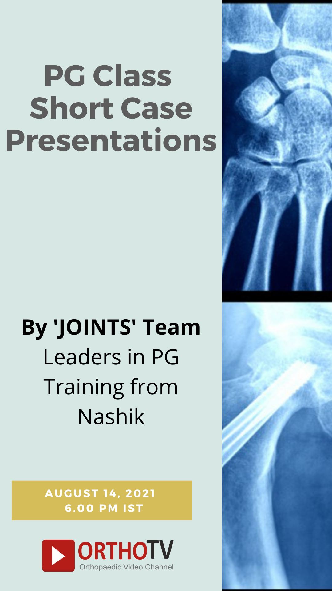 PG Class Short Case Presentations by JOINTS