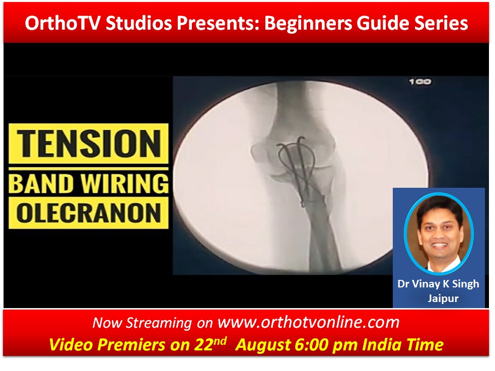 Beginners Guide Series : Tension Band Wiring: Tips & Tricks by Dr Vinay Kumar Singh