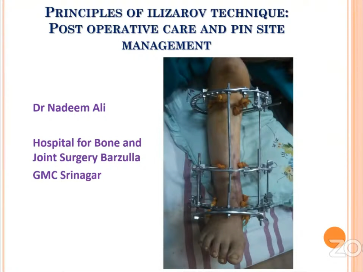 Principle of Ilizarov Technique: Post Operative Care & Pin Site Management -Dr Nadeem Ali