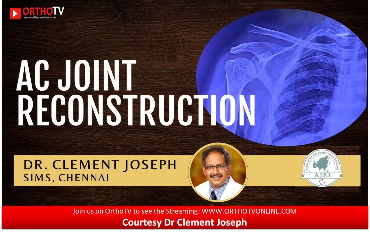 AC Joint Reconstruction by Dr Clement Joseph