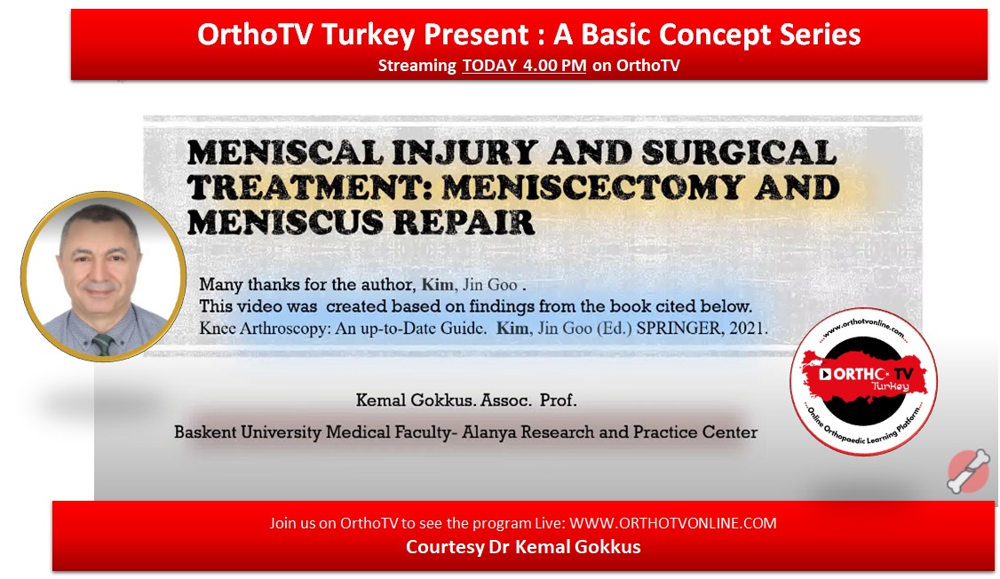 Meniscal Injury and Surgical Treatment: Meniscectomy and Meniscus Repair : A basic Concept Lecture by Dr Kemal Gokkus