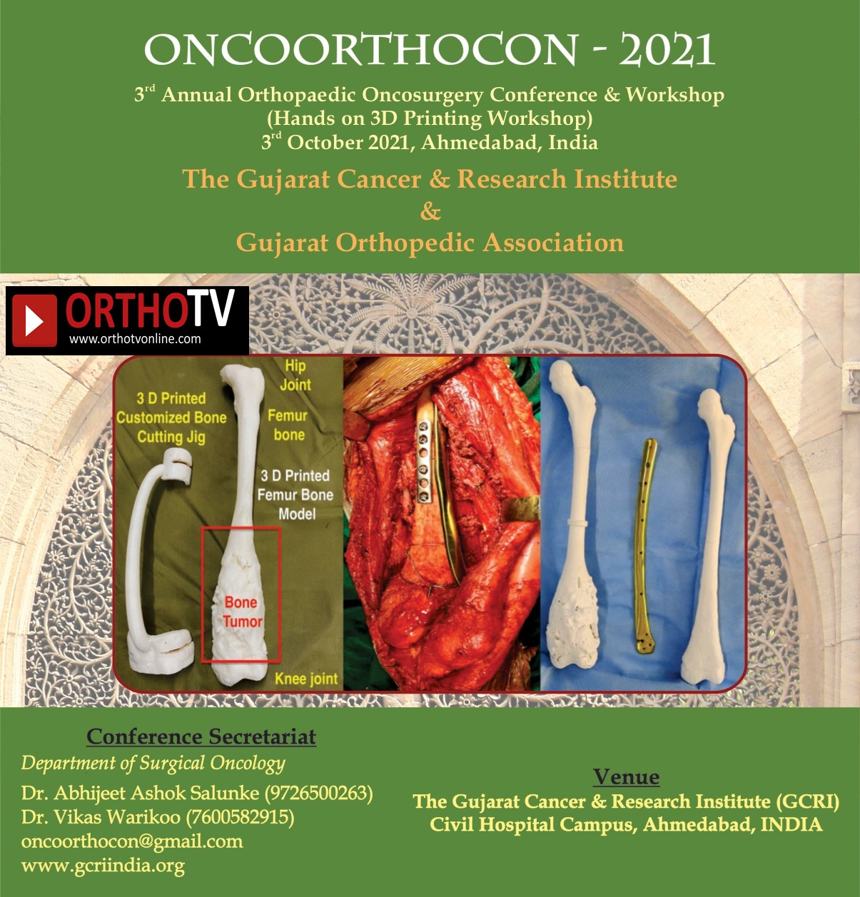 ONCOORTHOCON 2021 (3 rd Annual Orthopaedic Oncosurgery Conference & Workshop )