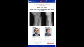 AO North America Master Class Series : Session 1 Topic: Distal Radius Malunion – When and how to Correct?