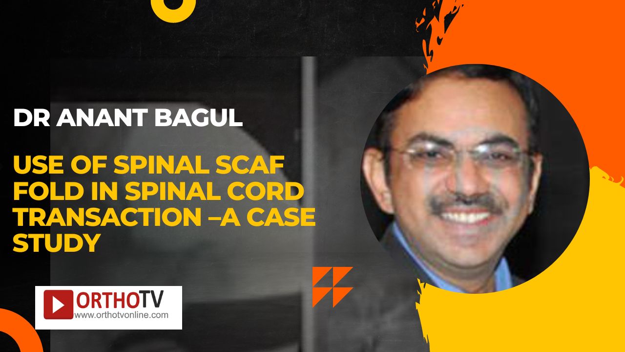 Dr Anant Bagul - Use of spinal scaf fold in spinal cord transaction –a case study