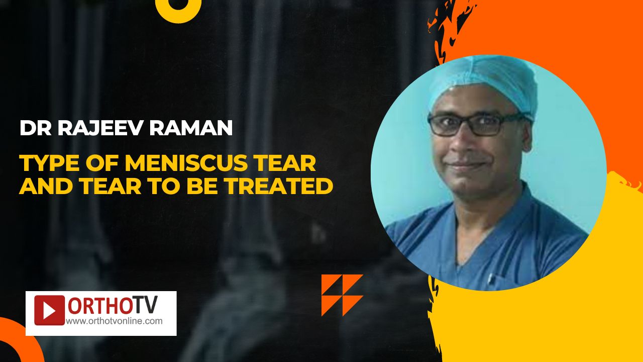 Dr Rajeev Raman - Type of Meniscus Tear and Tear to be Treated