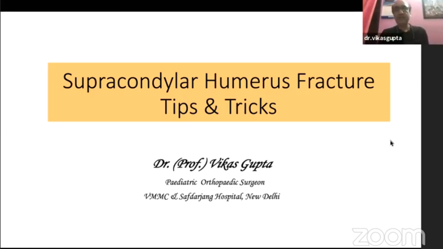 Supracondylar humerus fracture Tips & Tricks 