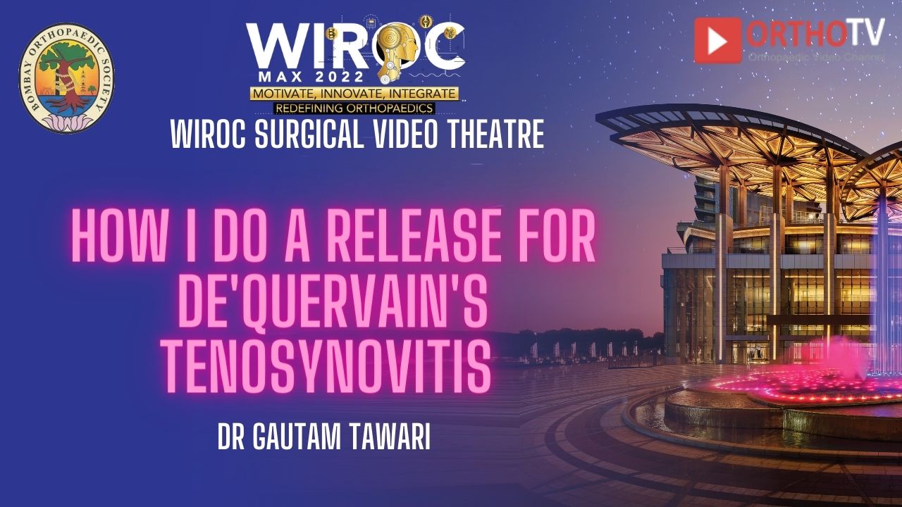 How I do a Release for De'Quervain's Tenosynovitis Dr Gautam Tawari