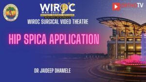 Hip Spica application Dr Jaideep Dhamele