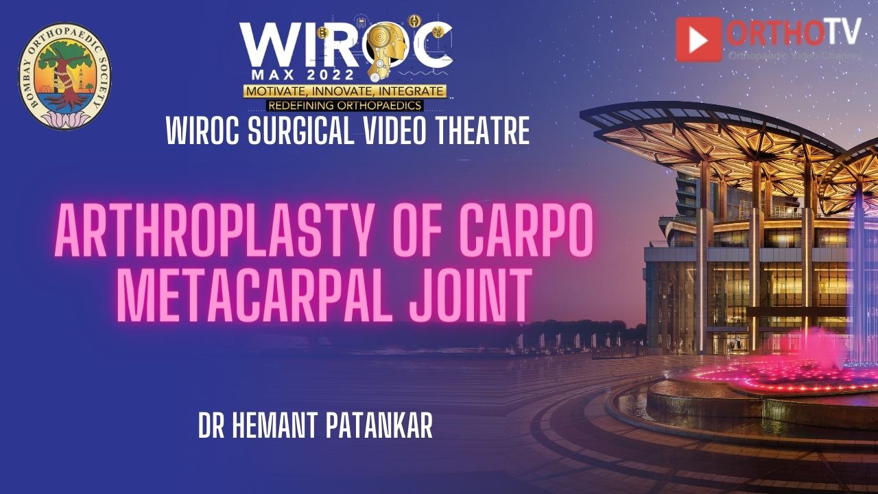 Arthroplasty of Carpo Metacarpal Joint Dr Hemant Patankar