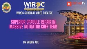 Superior cpasule repair in massive Rotoator Cuff tear Dr Vaibhv Koli