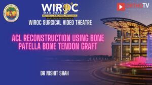 ACL Reconstruction using Bone Patella Bone Tendon graft Dr Nishit Shah