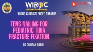 TENS Nailing for pediatric tibia fracture fixation Dr Chintan Doshi