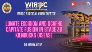 Lunate Excision and Scapho Capitate fusion in stage 3B kienbocks Disease Dr Warid Altaf