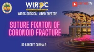 Suture fixaton of Coronoid fracture Dr Sangeet Gawhale