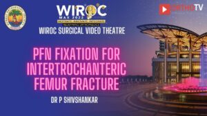 PFN fixation for Intertrochanteric femur fracture Dr P Shivshankar