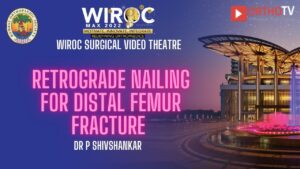 Retrograde nailing for Distal femur fracture Dr P Shivshankar