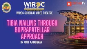 Tibia Nailing through suprapatellar approach Dr Amit Ajgaonkar