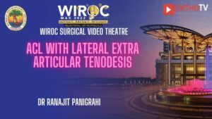 ACL with Lateral extra articular tenodesis Dr Ranajit Panigrahi