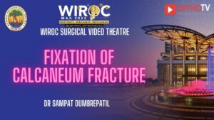 Fixation of Calcaneum fracture Dr Sampat DumbrePatil