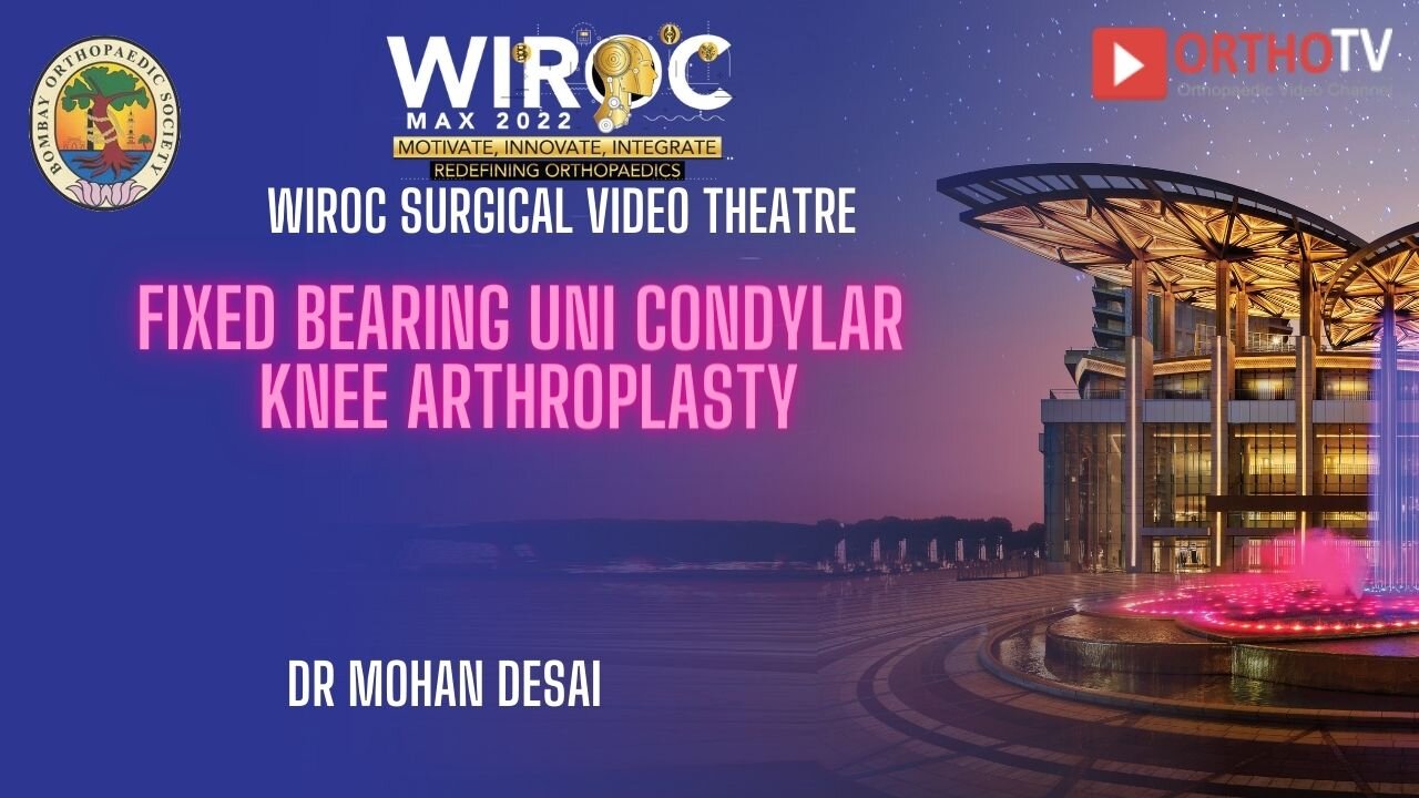 Fixed bearing uni condylar knee arthroplasty Dr Mohan Desai