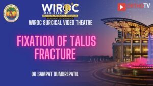 Fixation of Talus fracture Dr Sampat DumbrePatil