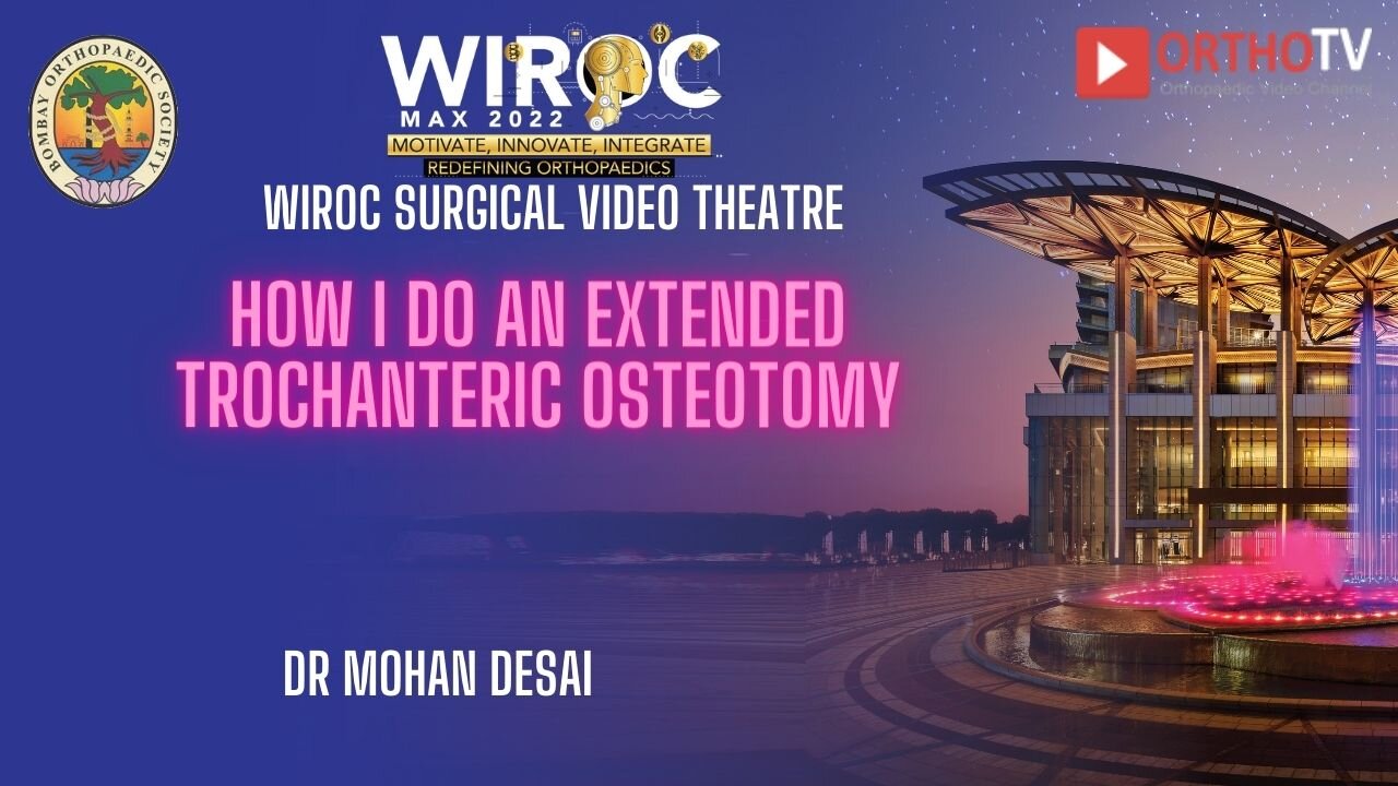 How I do an extended trochanteric osteotomy Dr Mohan Desai