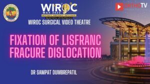 Fixation of Lisfranc fracure dislocation Dr Sampat DumbrePatil