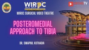 Posteromedial Approach to Tibia Dr. Swapnil Kothadia