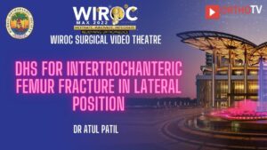 DHS for Intertrochanteric femur fracture in lateral Position Dr Atul Patil