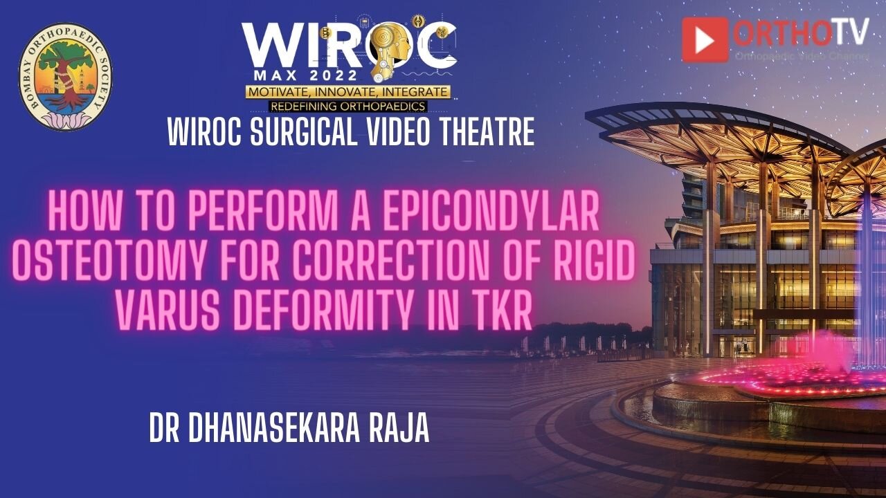 How to perform a epicondy Dr Dhanasekara Rajalar osteotomy for correction of rigid varus deformity in TKR 