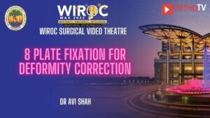 8 plate fixation for deformity correction Dr Avi Shah
