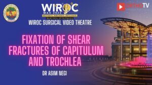 Fixation of Shear Fractures of capitulum and trochlea Dr Asim Negi