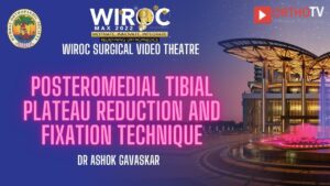 Posteromedial tibial plateau reduction and fixation technique Dr Ashok Gavaskar