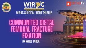 Communited Distal Femoral Fracture FixationDr Rahul Tanga
