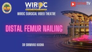 Distal Femur Nailing Dr Srinivas Kasha