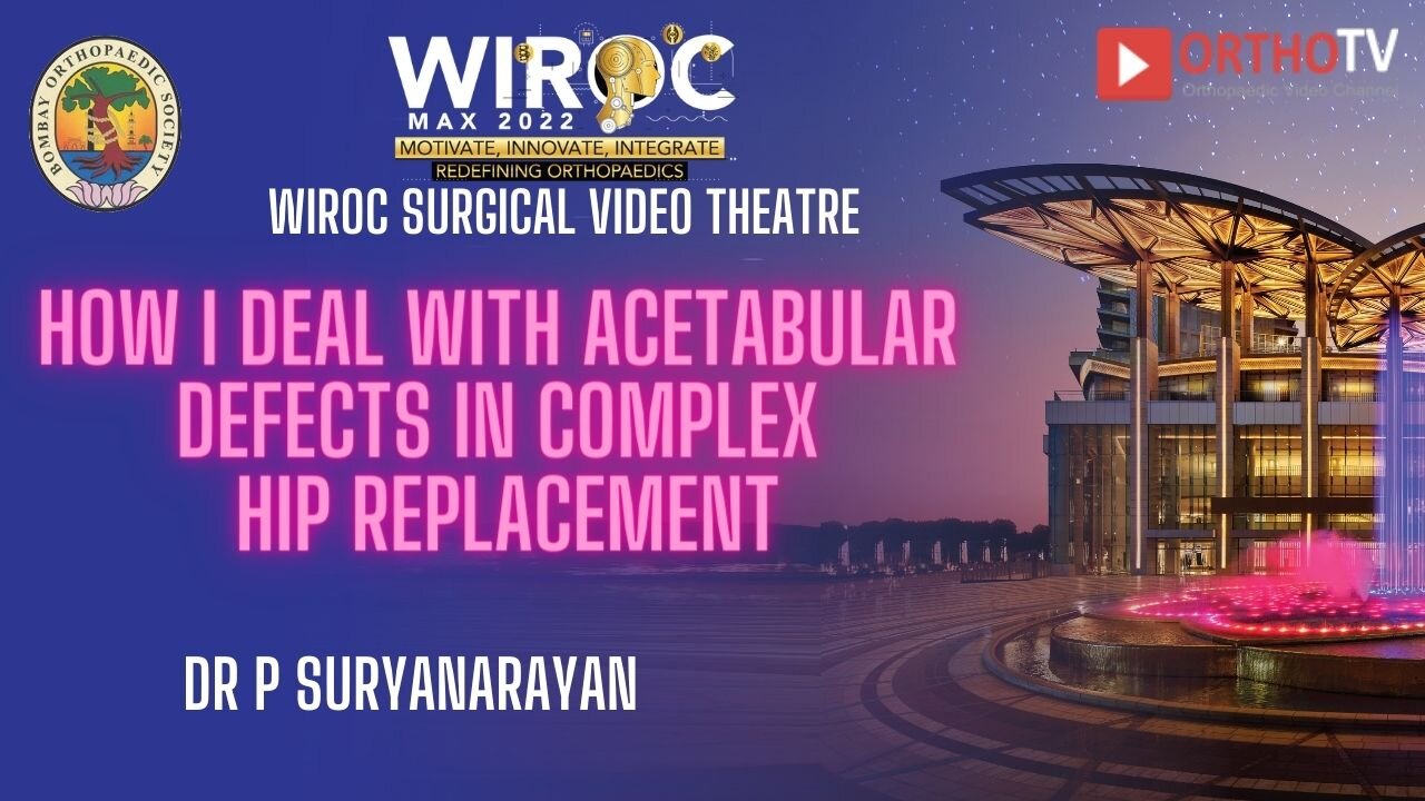 How I deal with acetabular defects in complex hip replacement Dr P Suryanarayan