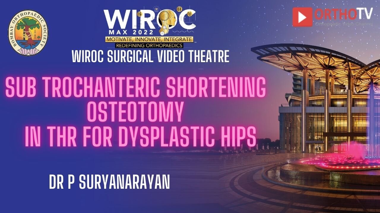 Sub trochanteric shortening osteotomy in THR for dysplastic hips Dr P Suryanarayan