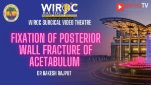 Fixation of posterior wall fracture of acetabulum Dr Rakesh Rajput