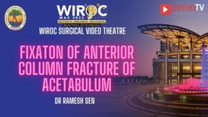 Fixaton of anterior column fracture of acetabulum Dr Ramesh Sen