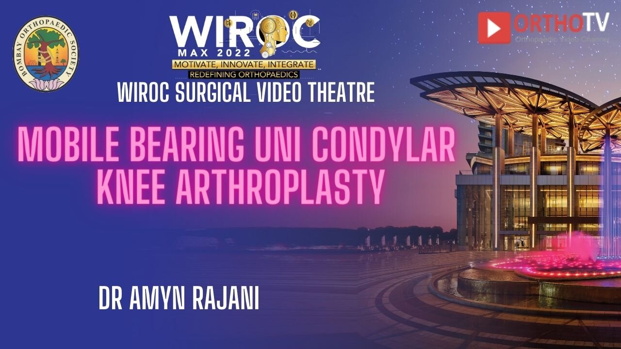Mobile bearing uni condylar knee arthroplasty Dr Amyn Rajani