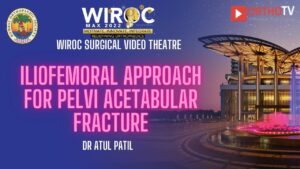 Iliofemoral Approach for Pelvi acetabular fracture Dr Atul Patil