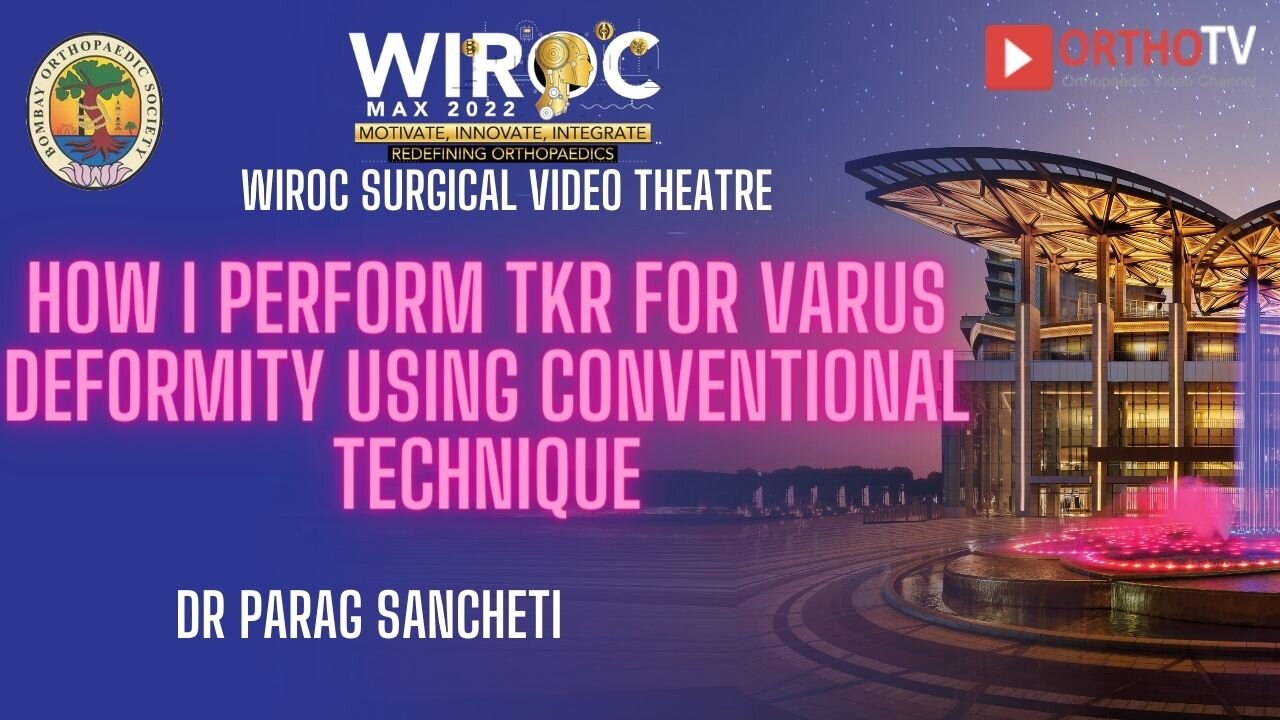 How I perform TKR for varus deformity using Conventional technique Dr Parag Sancheti 