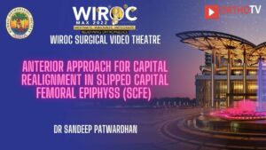 Anterior approach for Capital realignment in slipped capital femoral epiphyss (SCFE) Dr Sandeep Patwardhan