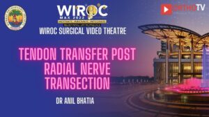Tendon transfer post radial nerve transection