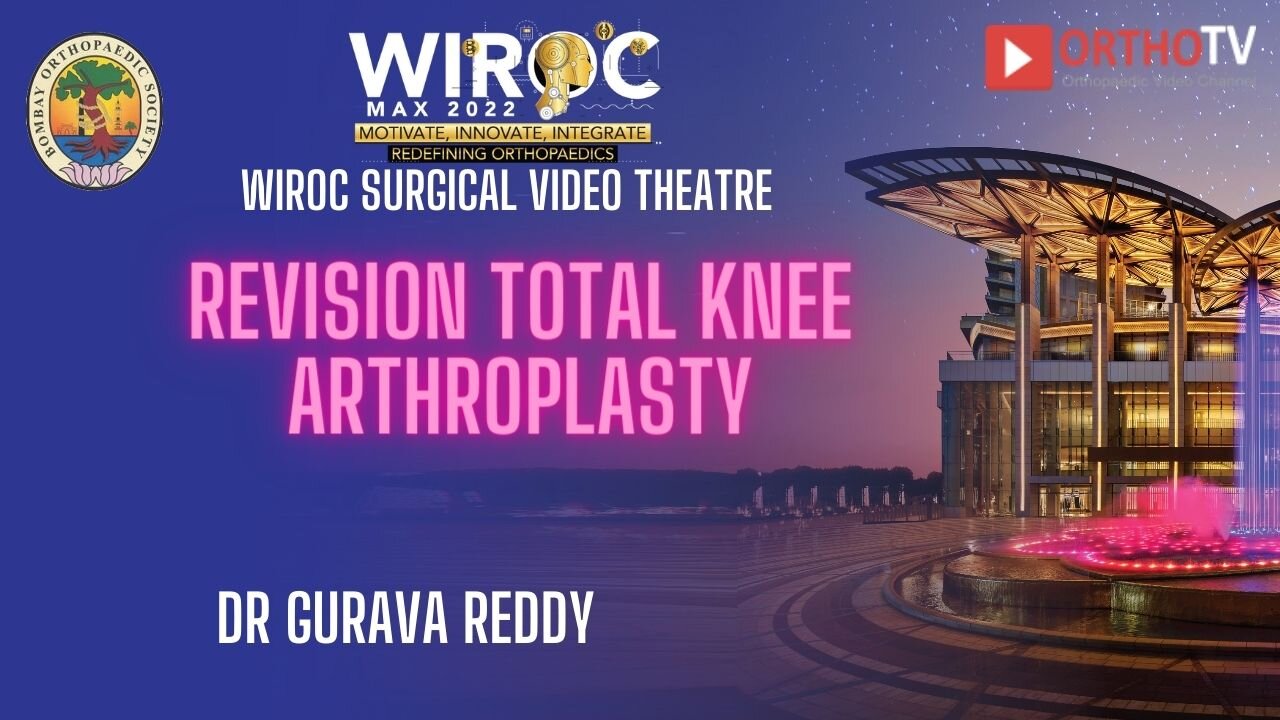 Revision total knee arthroplasty Dr Gurava Reddy