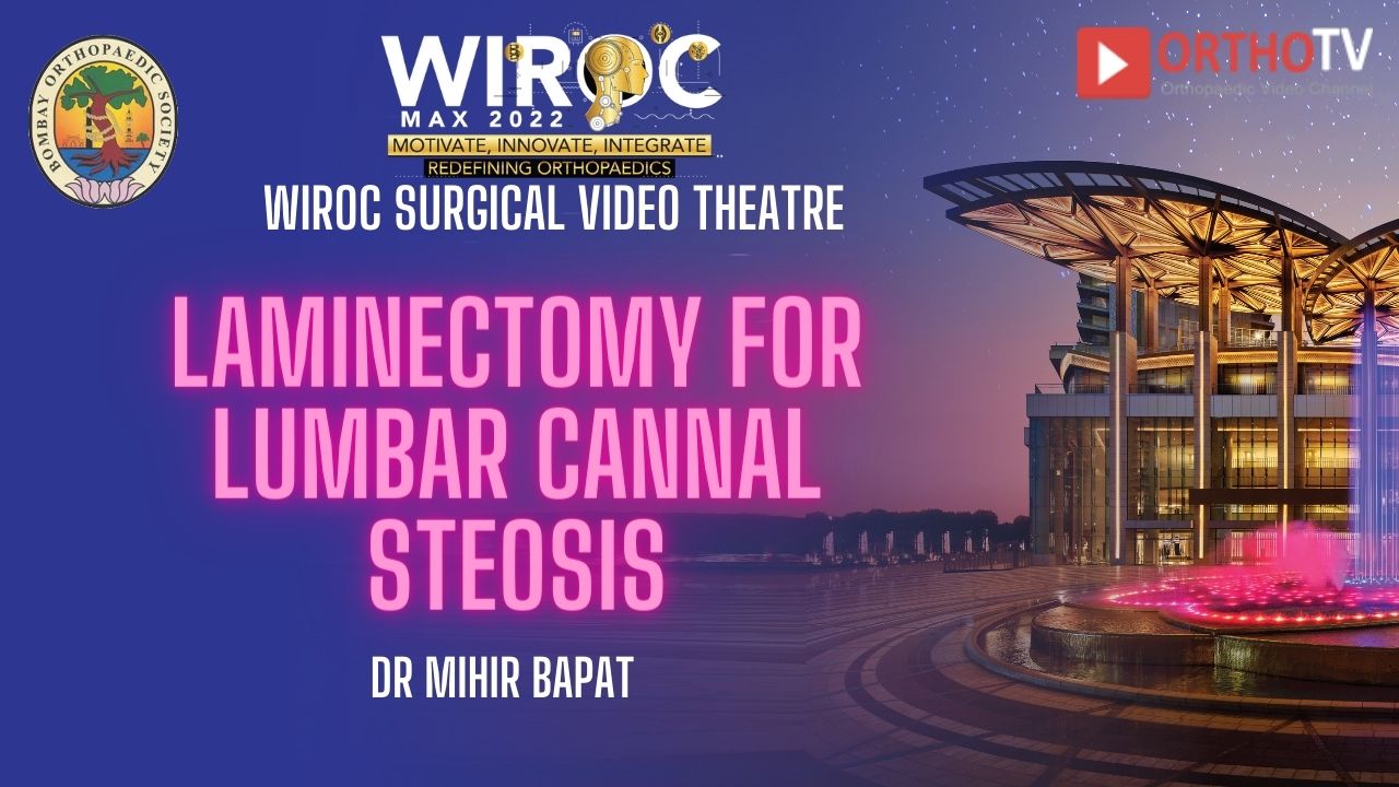 Laminectomy for Lumbar cannal steosis